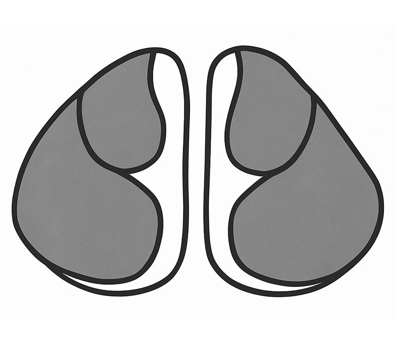 手術前(鼻の中)
